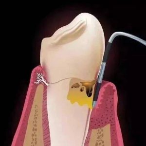 深度探索：寻找最佳来源购买香港VPS-